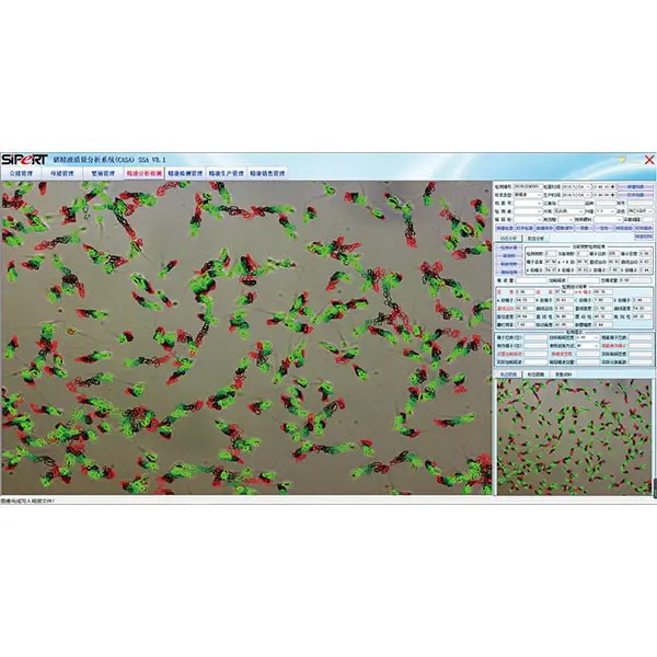 Phase difference CASA software Phase difference CASA software